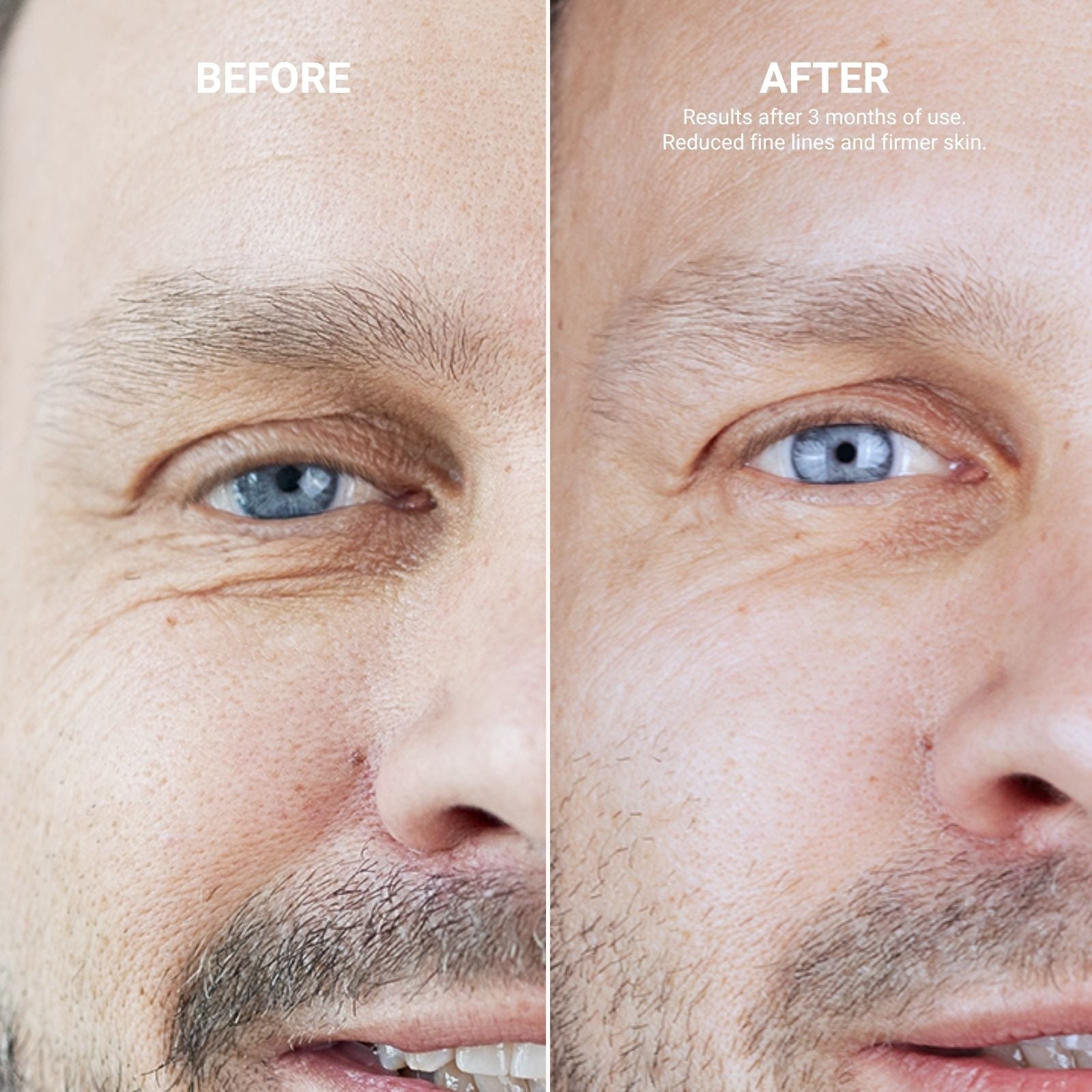 REFRESHING EYE CREAM WITH 0,2% RETINOL