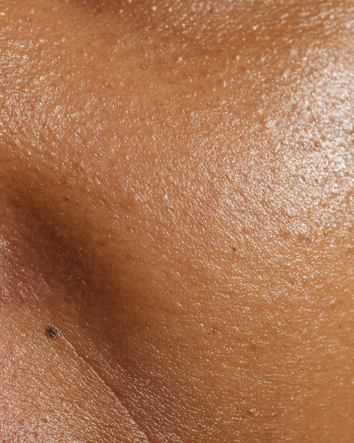 Normal skin