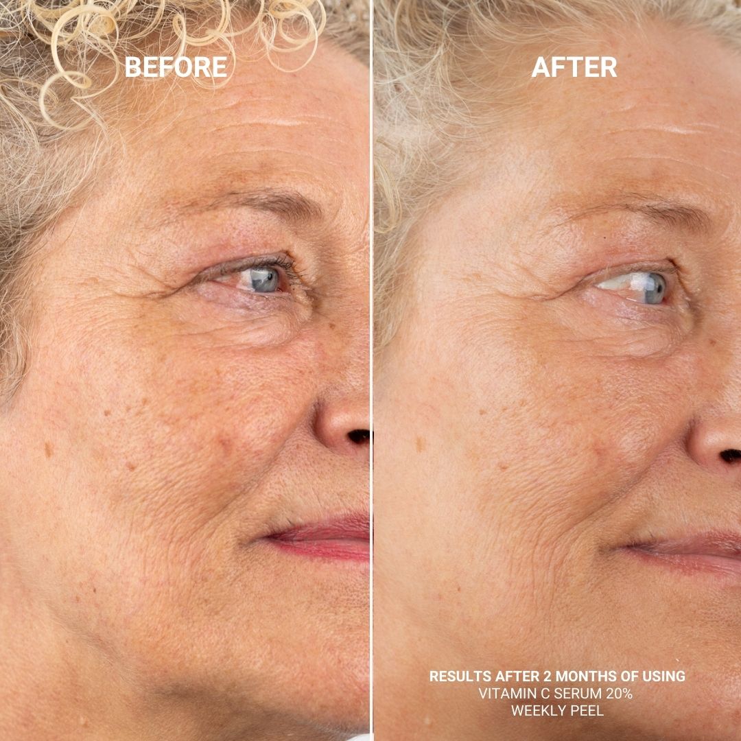 BUNDLE: VITAMIN C SERUM 20% + WEEKLY PEEL