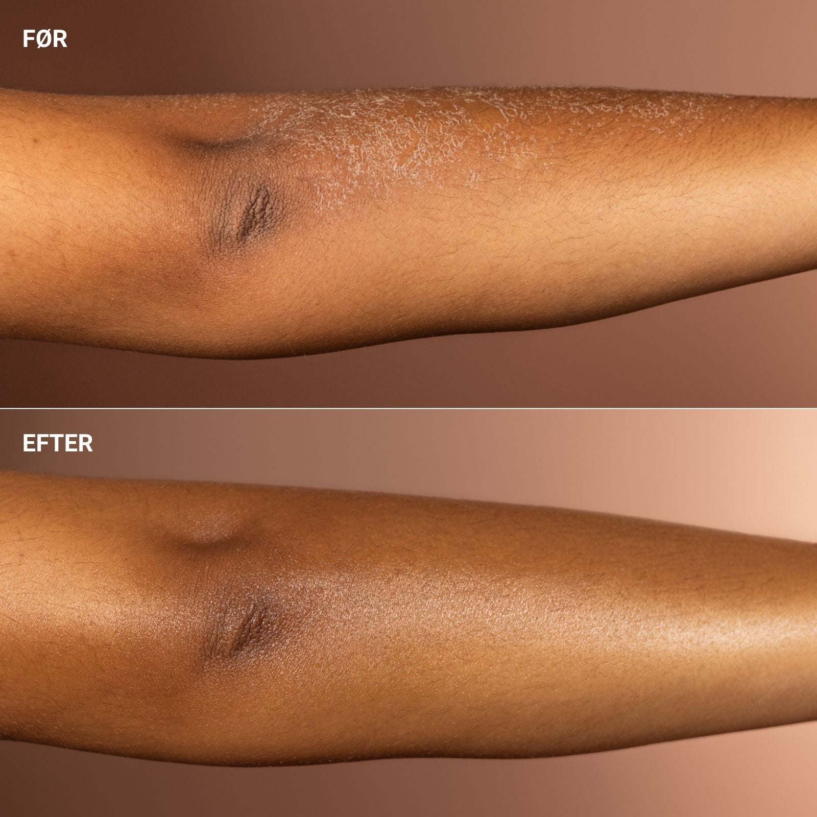 CICA REPAIR BALM
