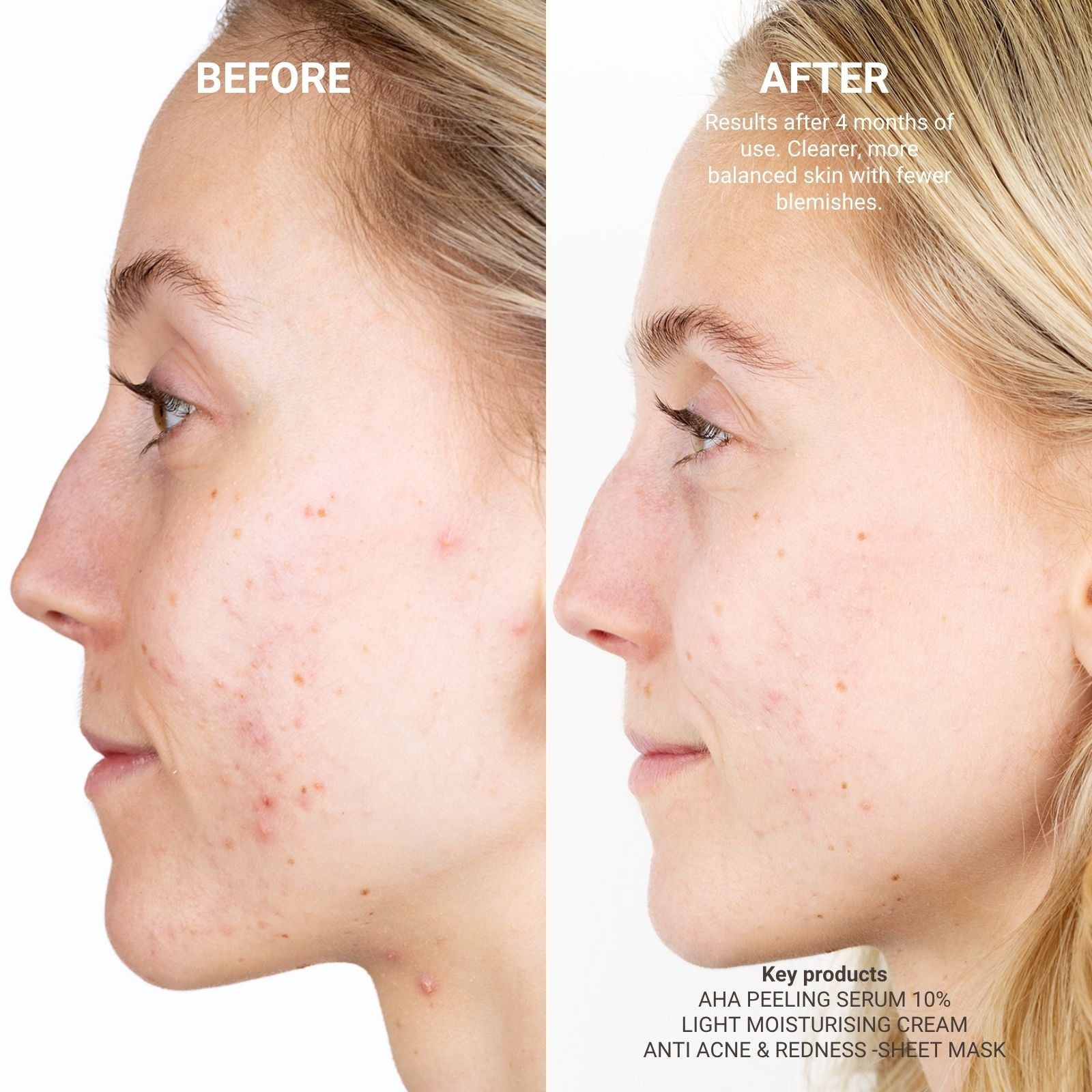 AHA PEELING SERUM 10%