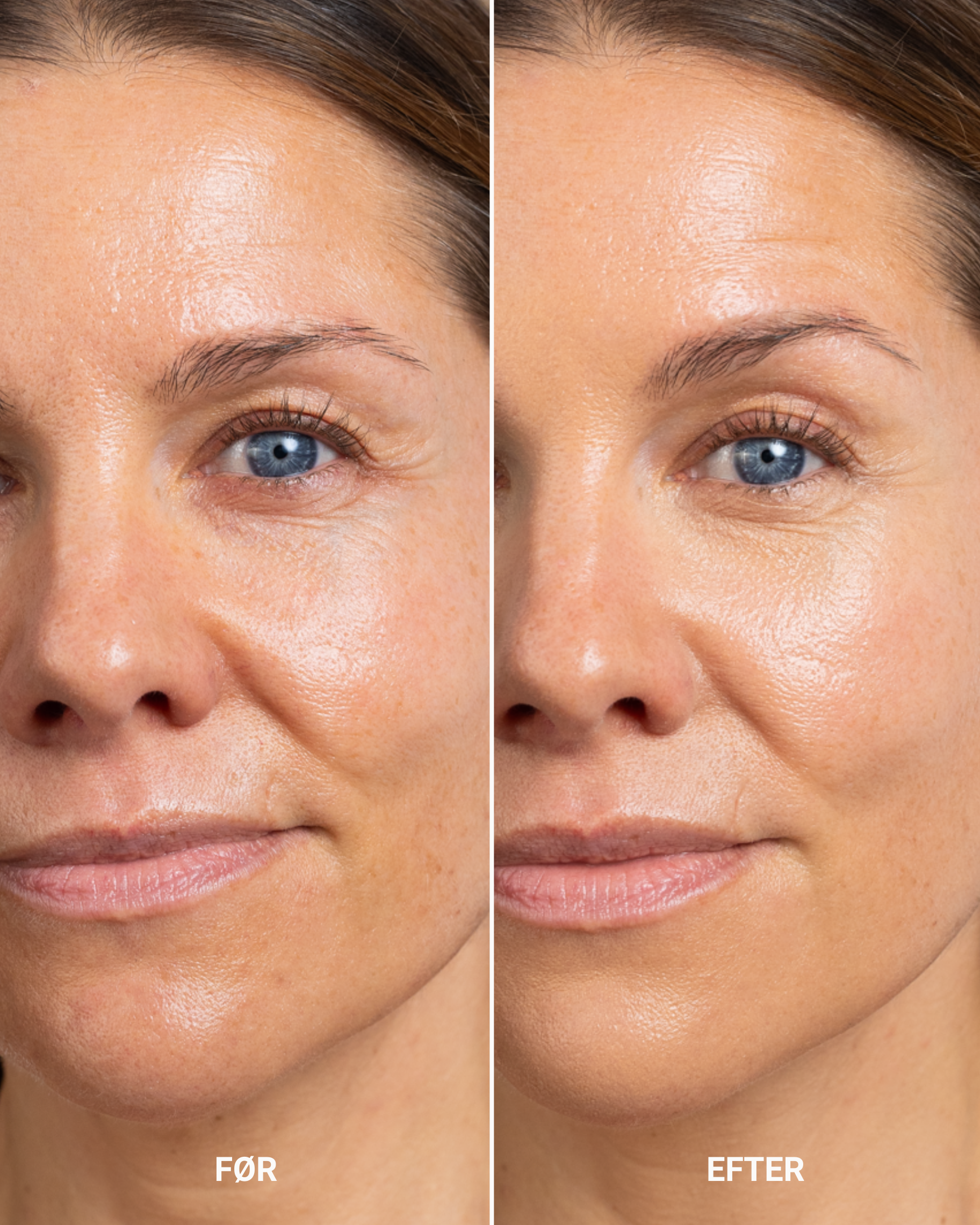 PERFECTING CONCEALER