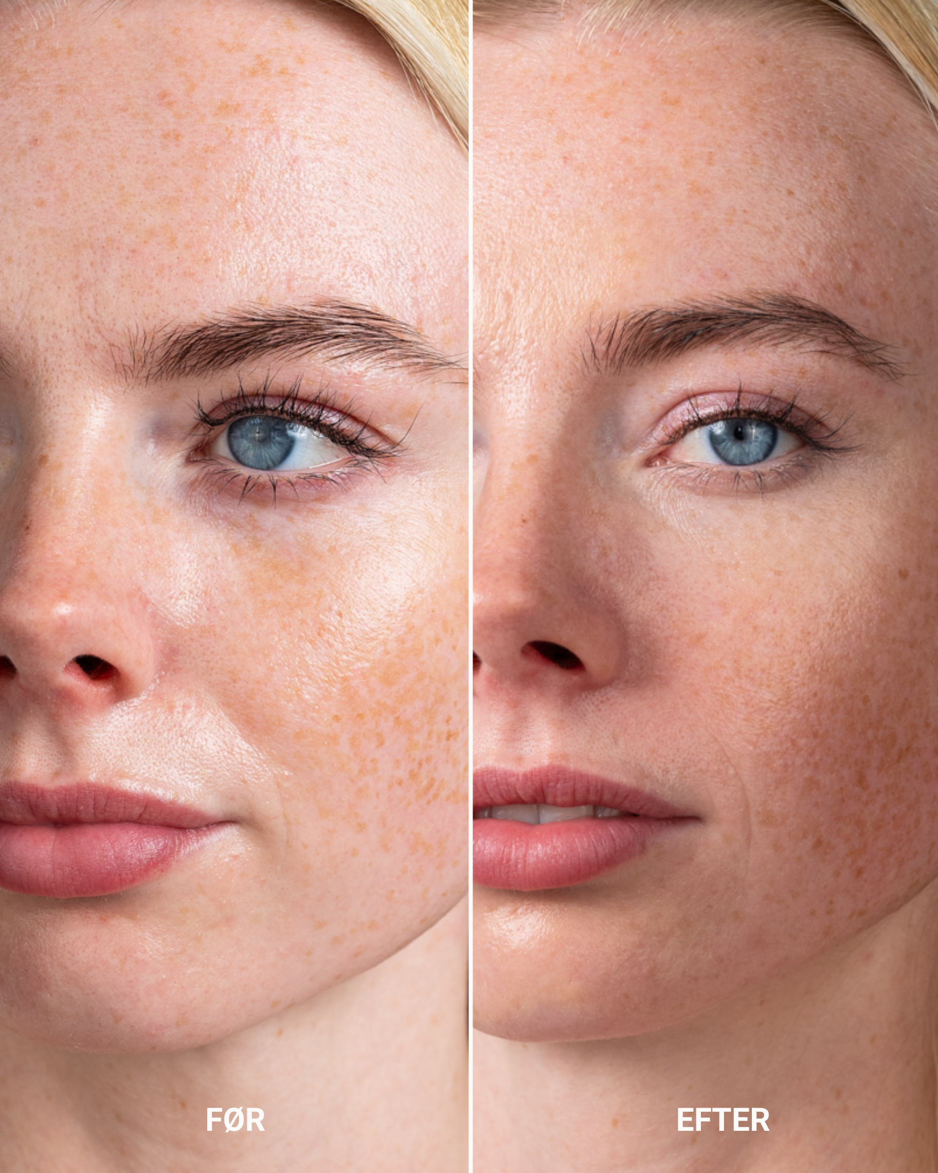 PERFECTING CONCEALER